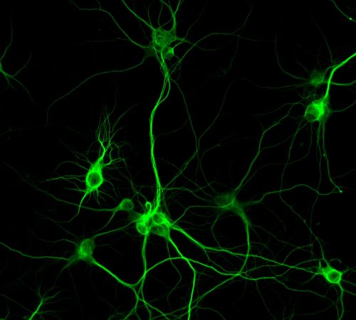 Primary-neuron-from-a-rat-cortext-taken-using-pE-800-1